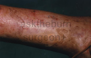 penis friction burn Pink pussy wife